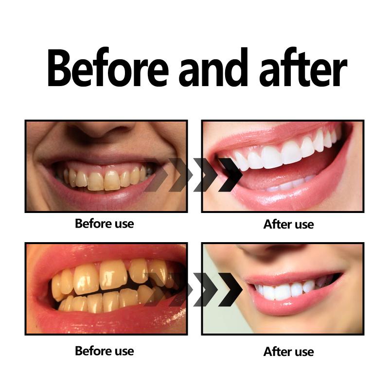 Teeth Whitening Powder Charcoa - огляд і ціна Teeth Whitening Baking Soda