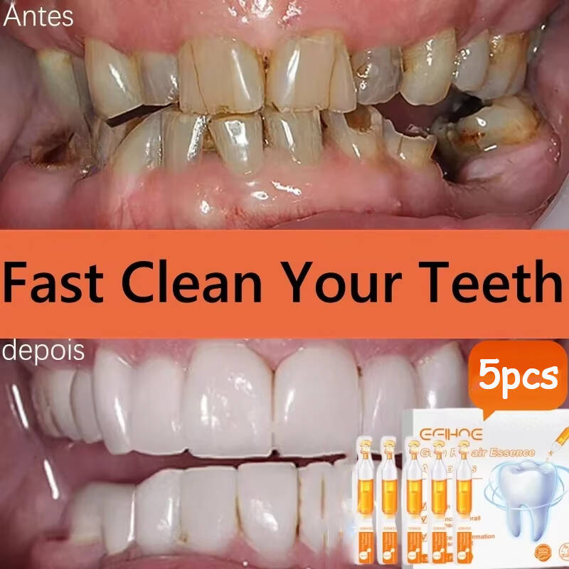 Quickly Repair Gum Serum Relie - огляд і ціна Teeth Whitening Baking Soda
