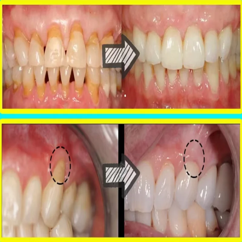 Quickly Repair Gum Serum Relie - огляд і ціна Teeth Whitening Baking Soda