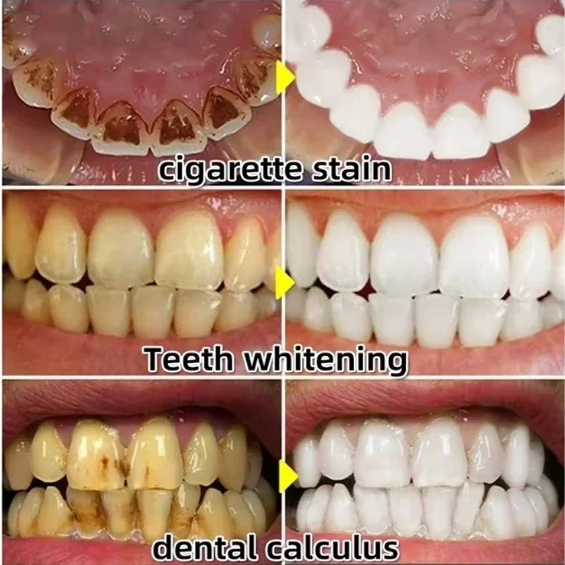 Quickly Repair Gum Serum Relie - огляд і ціна Teeth Whitening Baking Soda