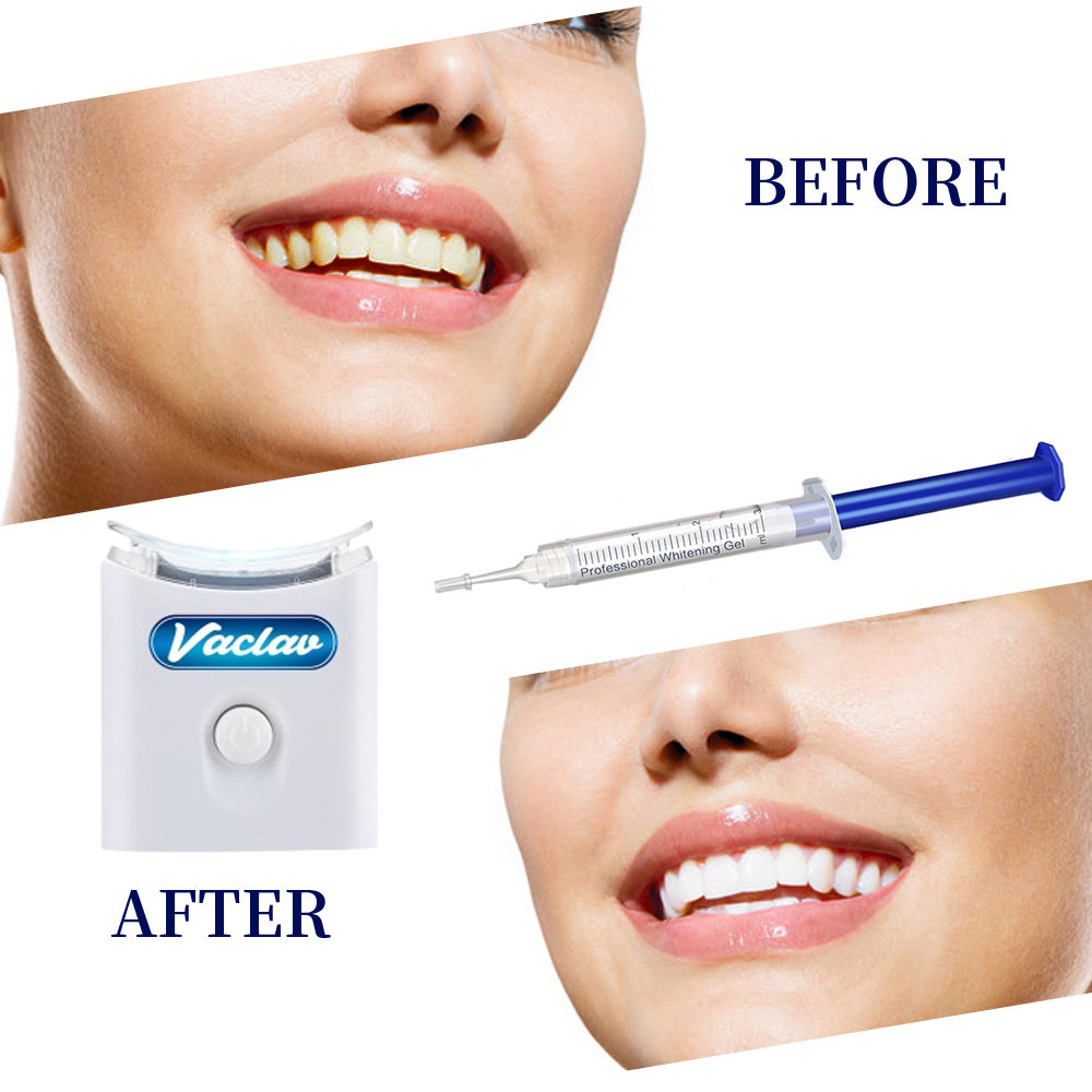 Mint Teeth Whitening Gel Syrin - огляд і ціна Teeth Whitening Baking Soda