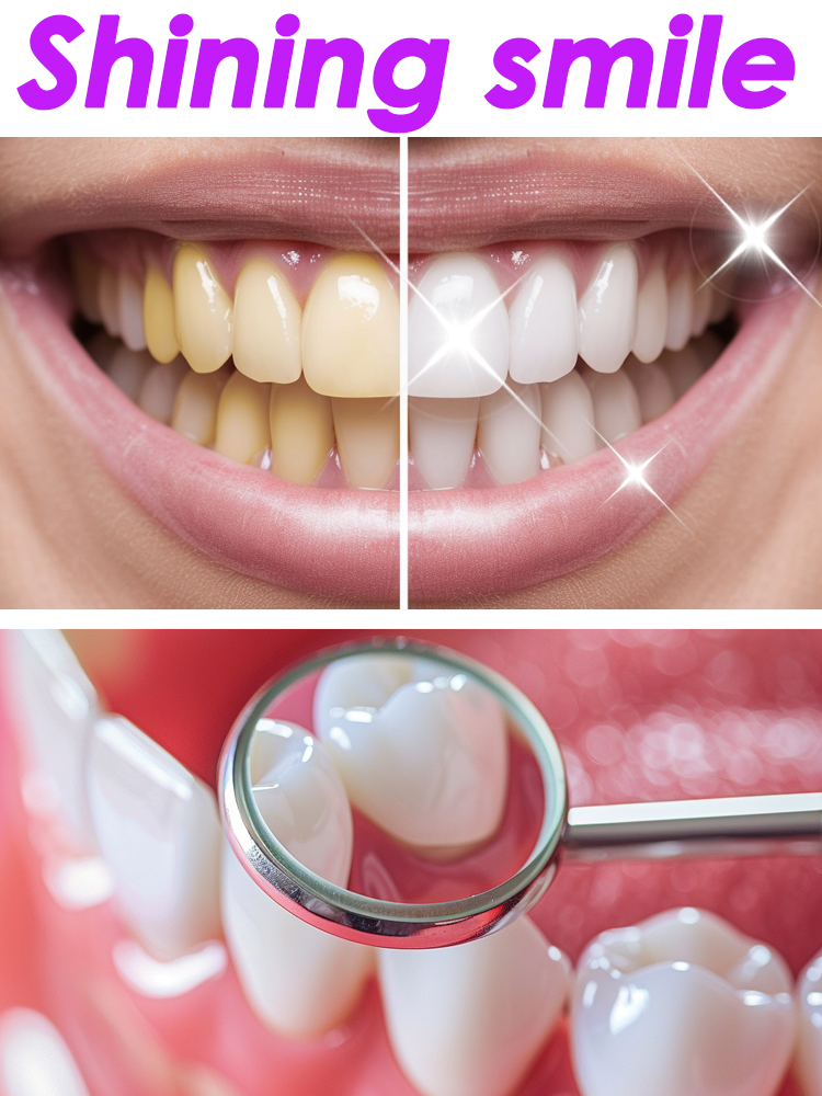 GlorySmile Teeth Whitening Fru - огляд і ціна Teeth Whitening Xylitol