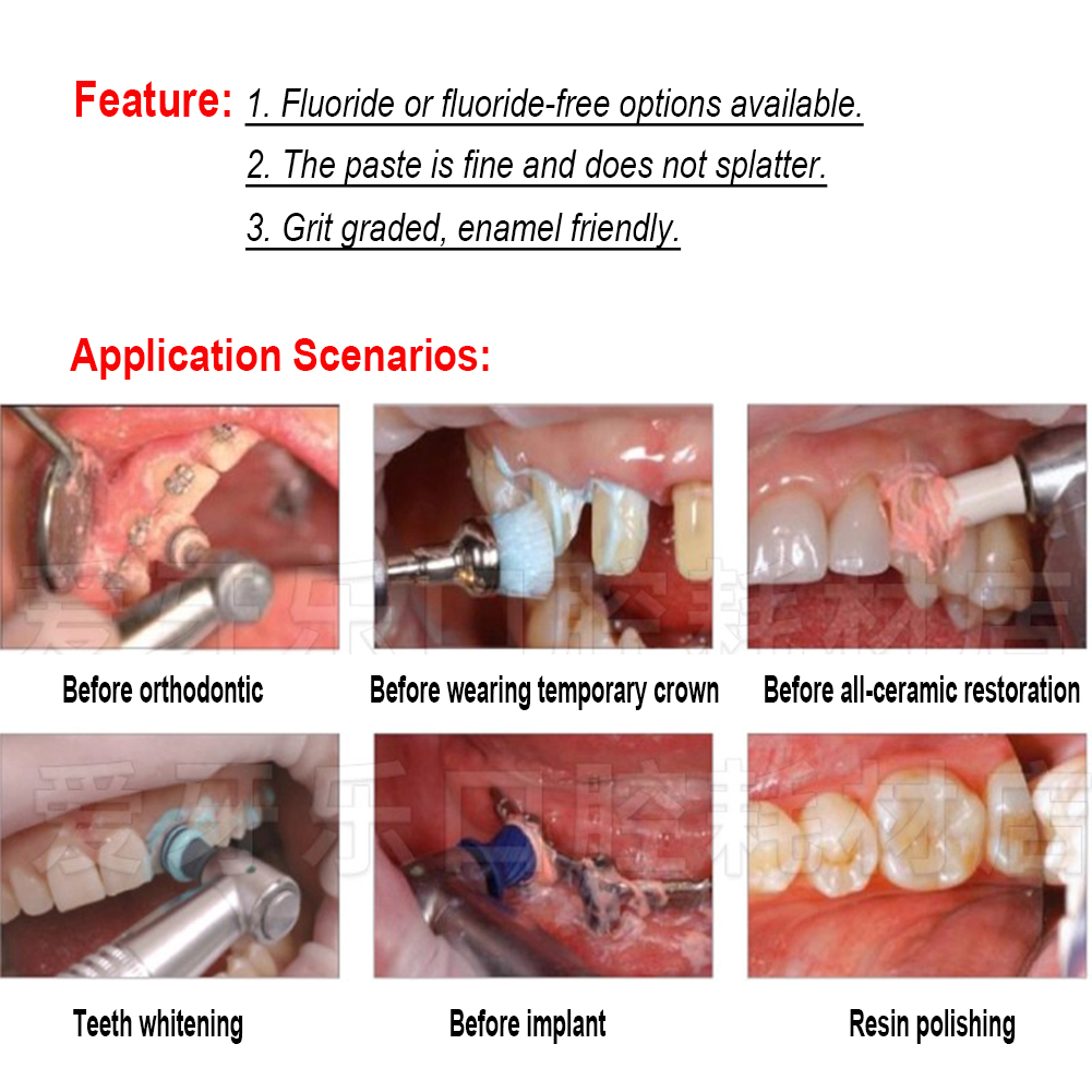 Ivoclar Vivadent Oral Teeth Po - огляд і ціна Teeth Whitening Xylitol