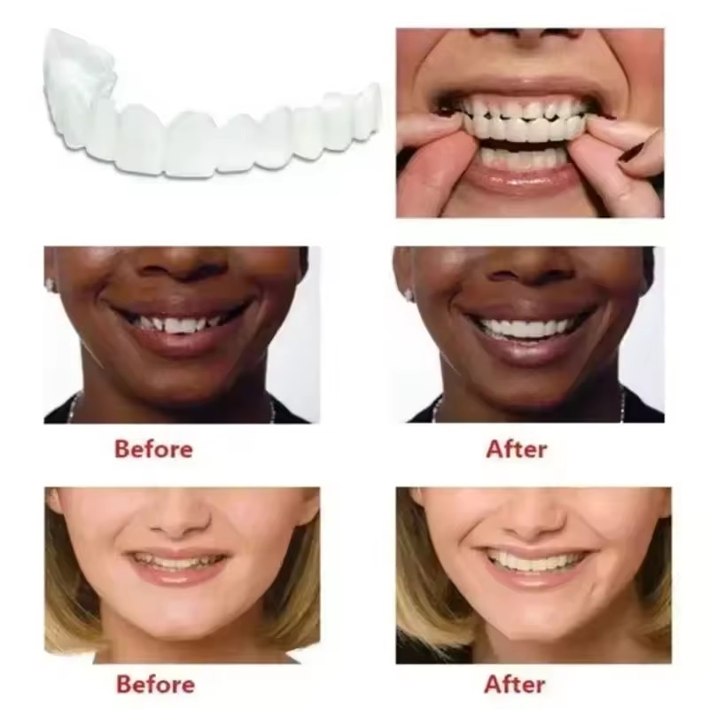 Teeth Veneers Whitening Dentur - огляд і ціна Teeth Whitening Kit