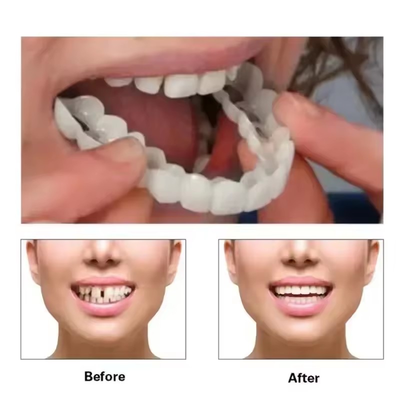 Teeth Veneers Whitening Dentur - огляд і ціна Teeth Whitening Kit