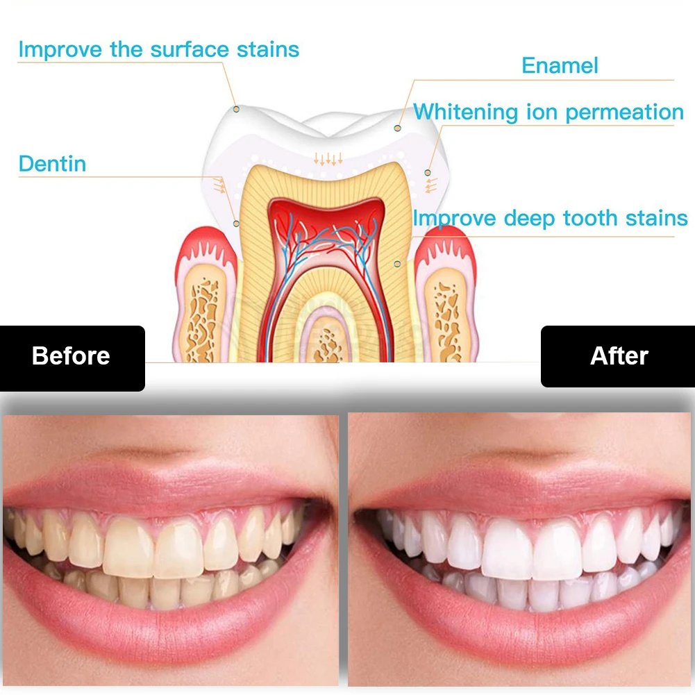 Dental Teeth Whitening Kit Min - огляд і ціна Teeth Whitening Doctor