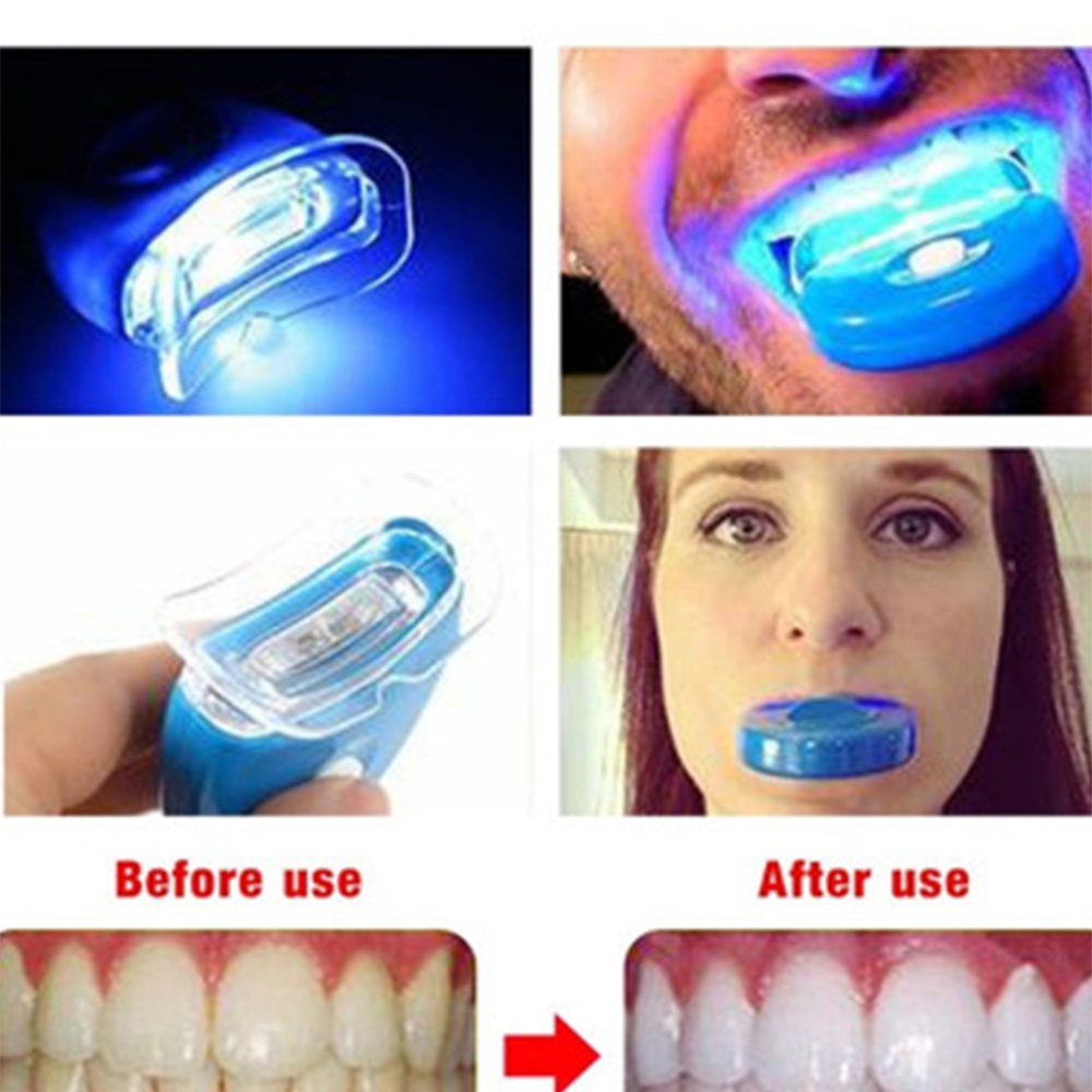 New Blue Led Teeth Whitening A - огляд і ціна Teeth Whitening Uv Kit