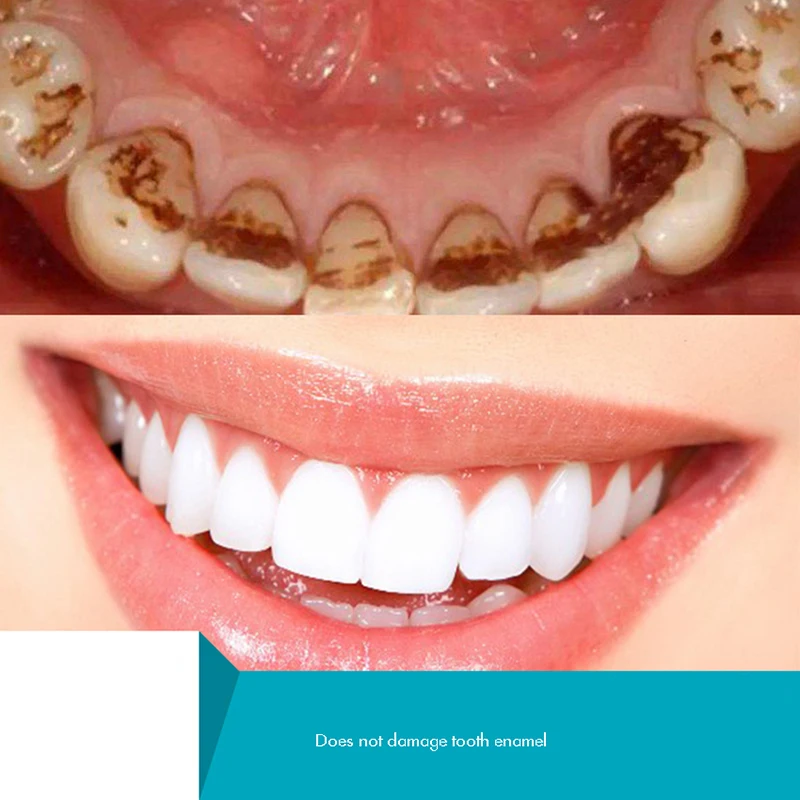 Herbal Tooth Powder, Natural T - огляд і ціна Teeth Whitening Xylitol