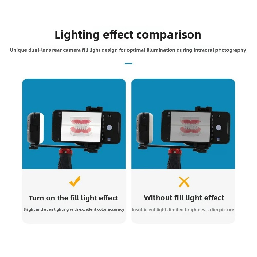 Dental Photography Light, Blue - огляд і ціна Teeth Whitening Kit