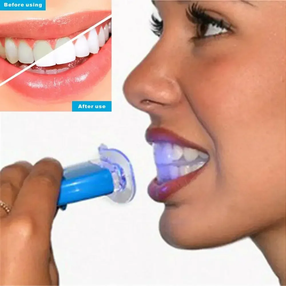 USB Quick Charge Beard & Body  - огляд і ціна Teeth Whitening Kit